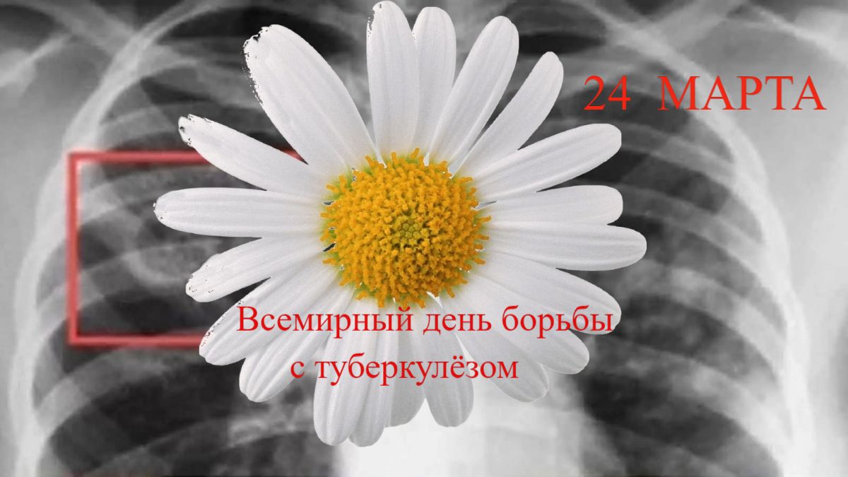 Туберкулез мой
